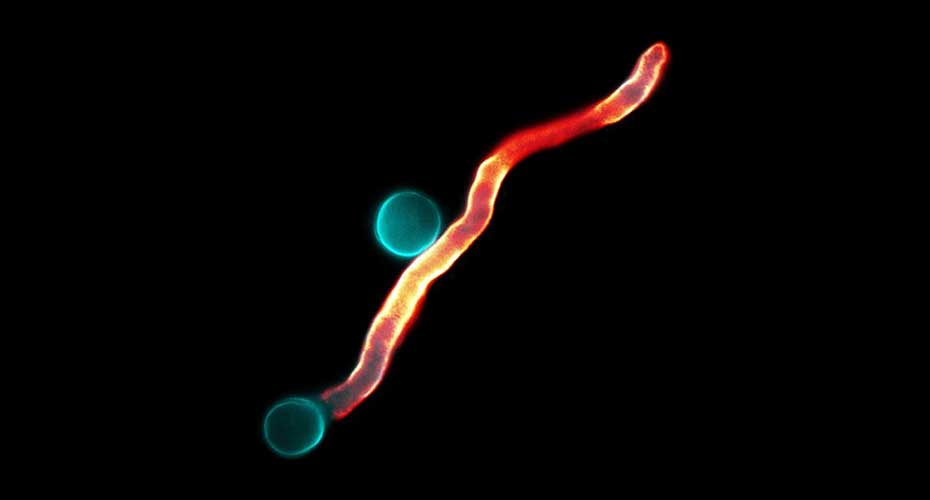 Mucorales under microscope